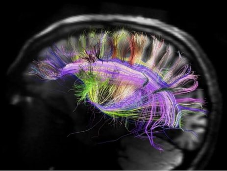 پژوهشگران برای اولین بار مغز انسان را به اینترنت متصل کردند